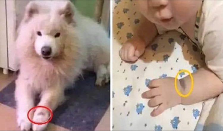 Kvinde forsikrer, at hendes baby er reinkarnationen af hendes hund på grund af modermærke